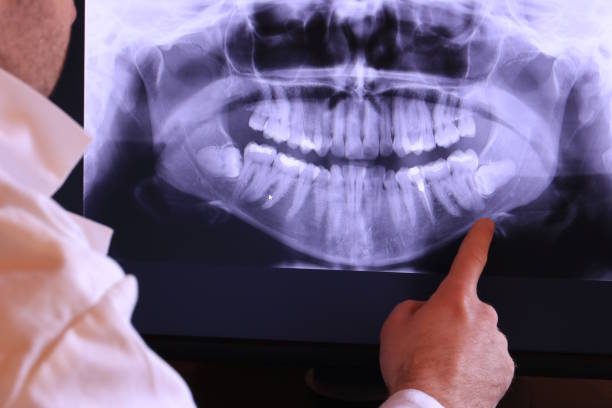 Best Same-Day Emergency Dental Services in Maplewood, WA