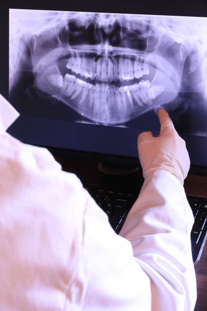 Best Emergency Treatment for Dental Infections or Abscesses in Maplewood, WA