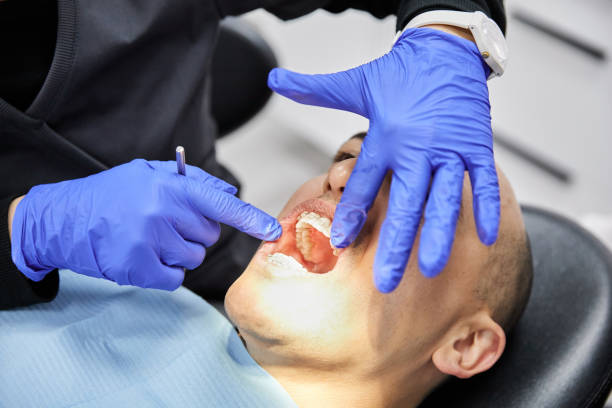 Best Emergency Treatment for Dental Infections or Abscesses in Maplewood, WA