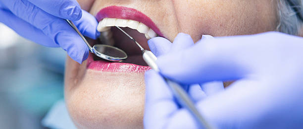 Best Emergency Tooth Extraction in Maplewood, WA